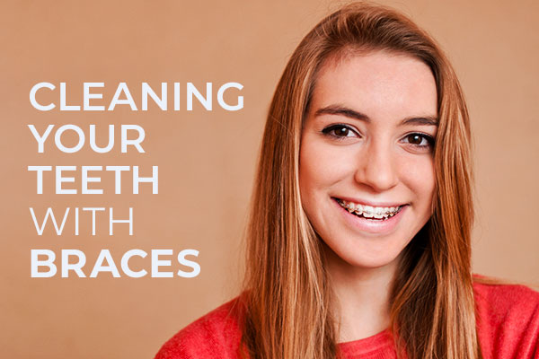 Cleaning your teeth with braces